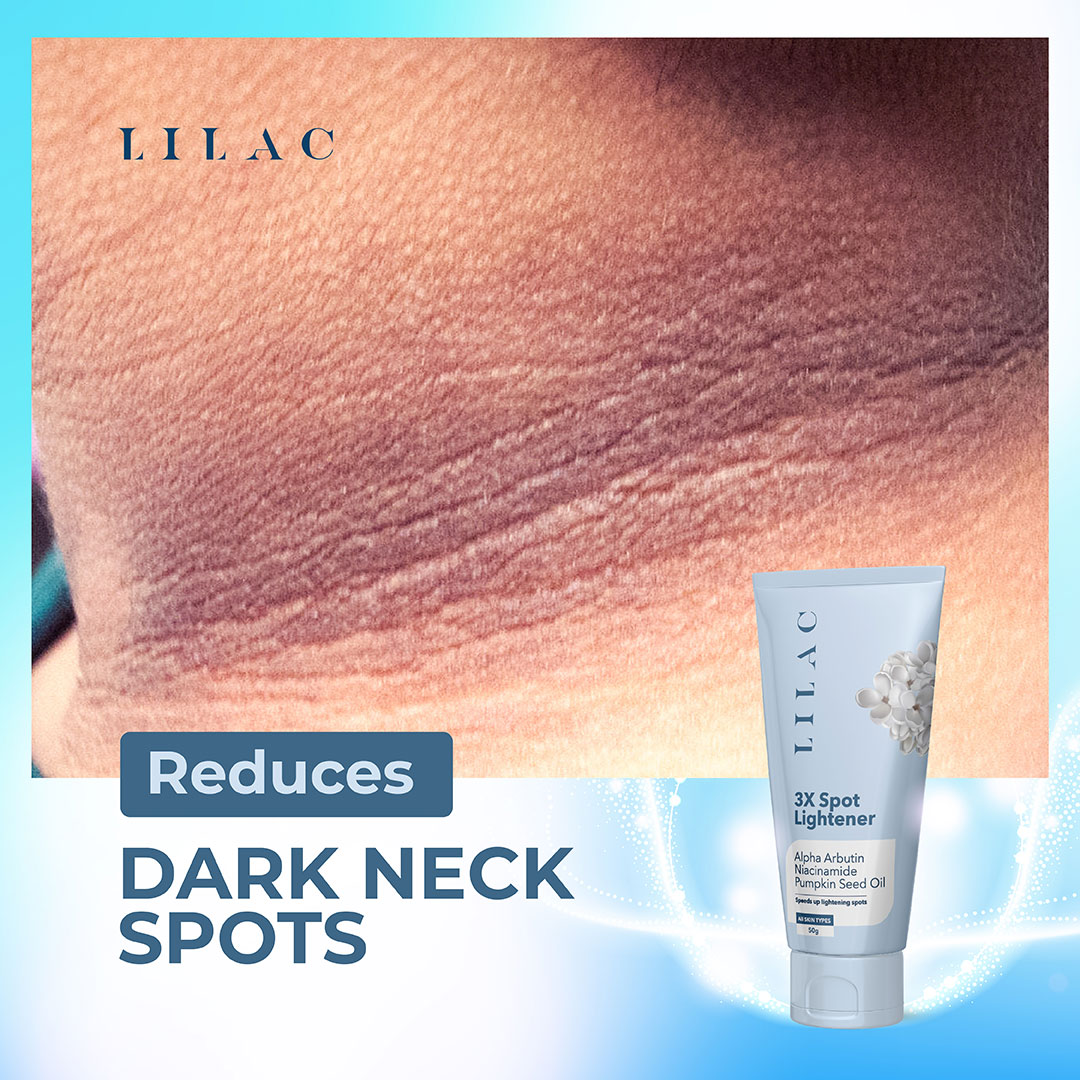 Lilac 3X Spot Lightener